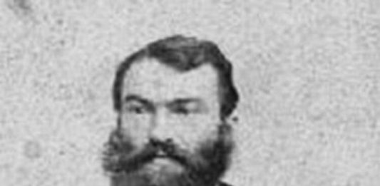 Znate li po kome se zove Parkinsonova bolest?